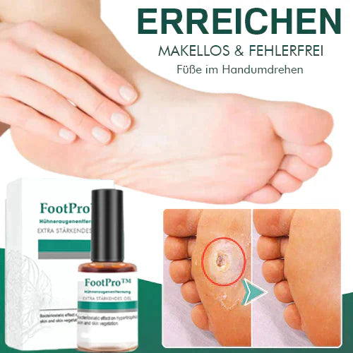 FootPro™️ Corn removal gel