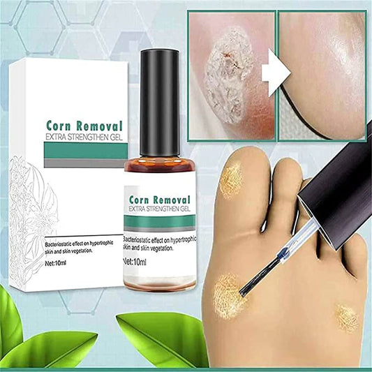 FootPro™️ Corn removal gel