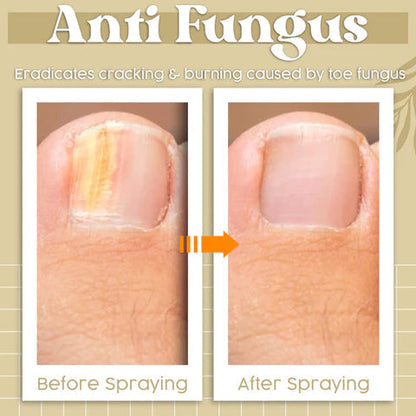 Herbcure™ Antifungal Spray