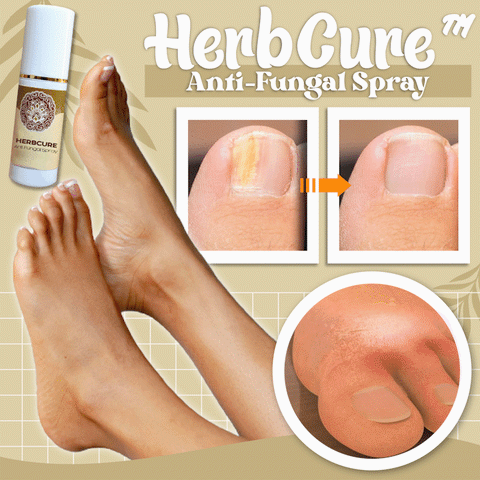 Herbcure™ Antifungal Spray