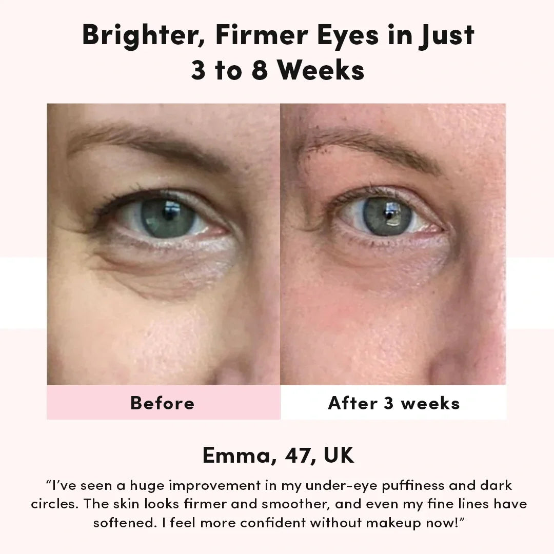Lumirané™ Soothing Eye Massager Reduces Dark Circles