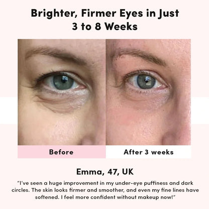 Lumirané™ Soothing Eye Massager Reduces Dark Circles
