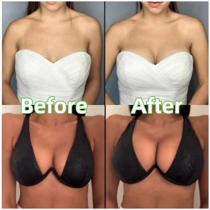 Lyfella™ Adhesive Lift Cups for Backless Outfits