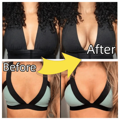 Lyfella™ Adhesive Lift Cups for Backless Outfits