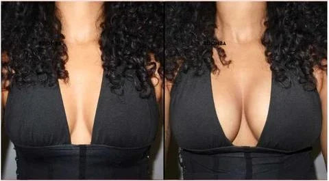 Lyfella™ Adhesive Lift Cups for Backless Outfits