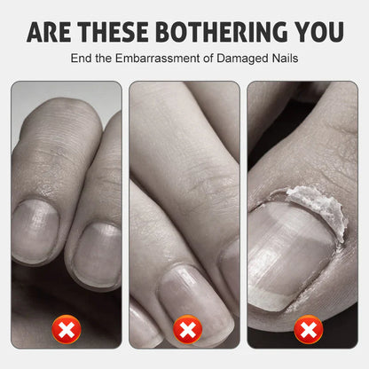 NourishNails™ Nourishing Nail Repair for Smooth, Healthy Nails