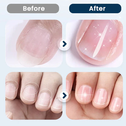 NourishNails™ Nourishing Nail Repair for Smooth, Healthy Nails