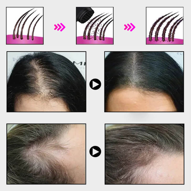 EELHOE HAIR™  Powder against hair loss and quick filling of the hairline