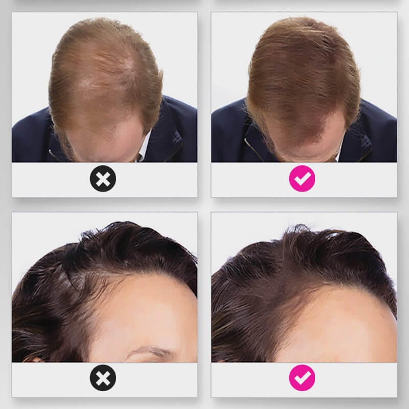 EELHOE HAIR™  Powder against hair loss and quick filling of the hairline