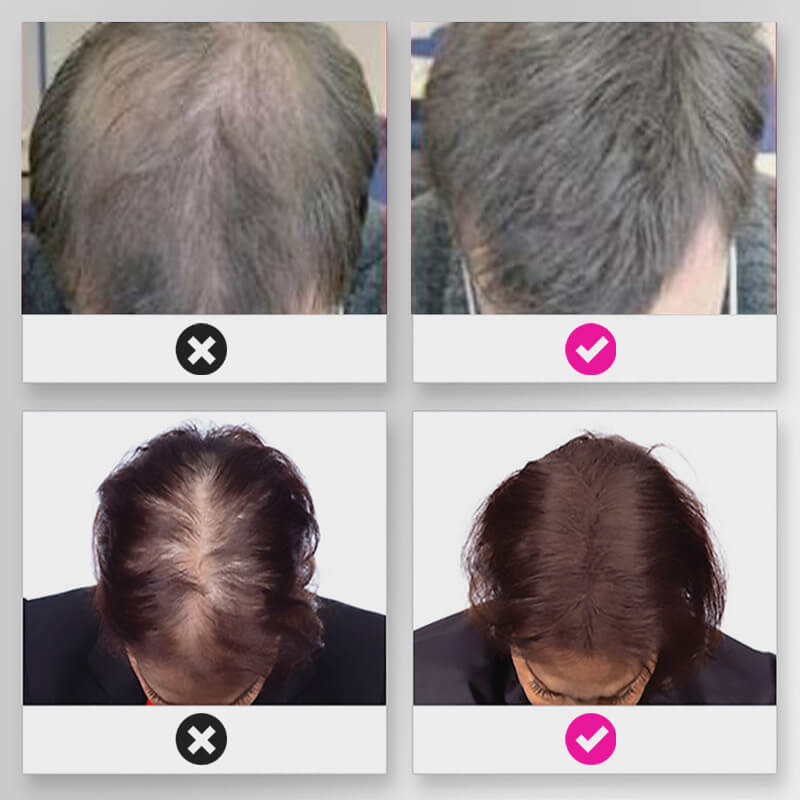 EELHOE HAIR™  Powder against hair loss and quick filling of the hairline
